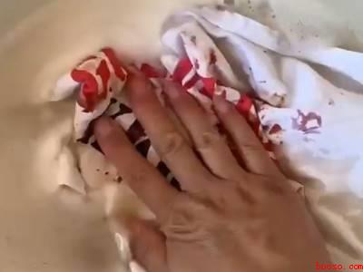 山竹弄到衣服上洗不掉怎么办