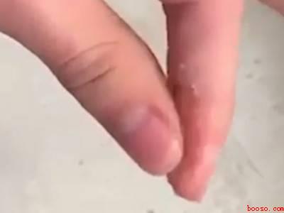 502沾了手上怎么弄掉