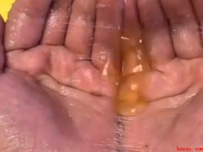 老鼠贴粘到手怎么洗掉