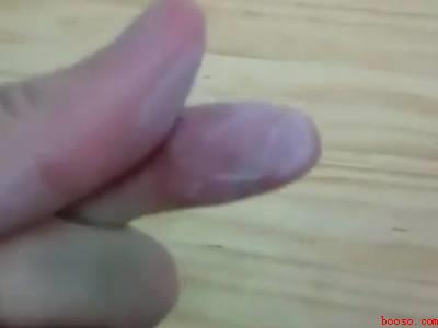 ab滴胶弄到手上怎么办