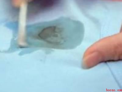 衣服上弄上墨水怎么洗掉