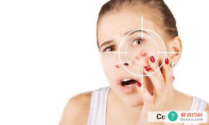 总是长痘痘怎么处理(脸上长痘痘应该怎么办)