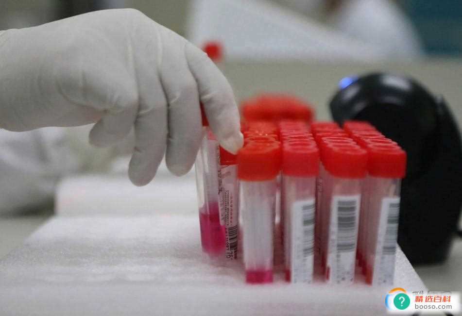 饶毅是核酸公司老板媒体核查(饶毅是核酸公司老板的详情)