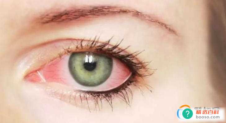 感染后眼睛疼怎么办