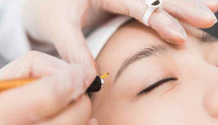 仙雾眉和丝雾眉的区别(纹眉是一种永久保持眉毛形状的美容外科方法)