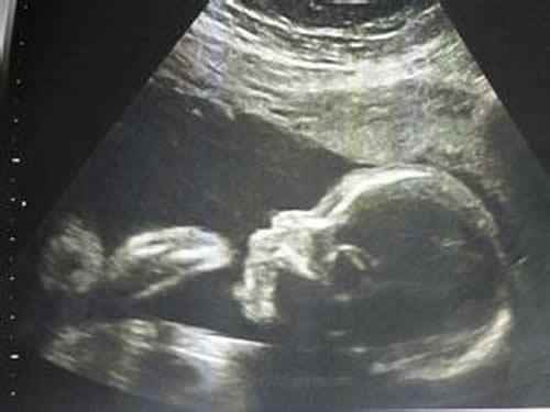 怀孕八个月胎儿图,怀孕8个月胎儿图,八个月胎儿图