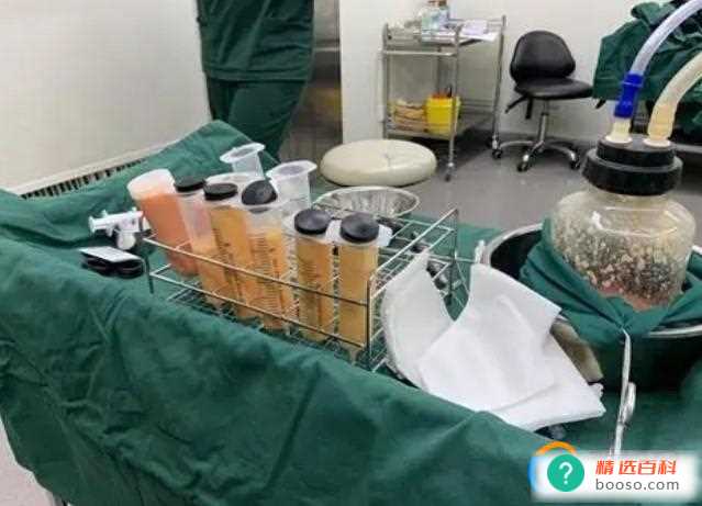 吸脂肪对身体有害吗(吸脂肪手术对身体是有害的)