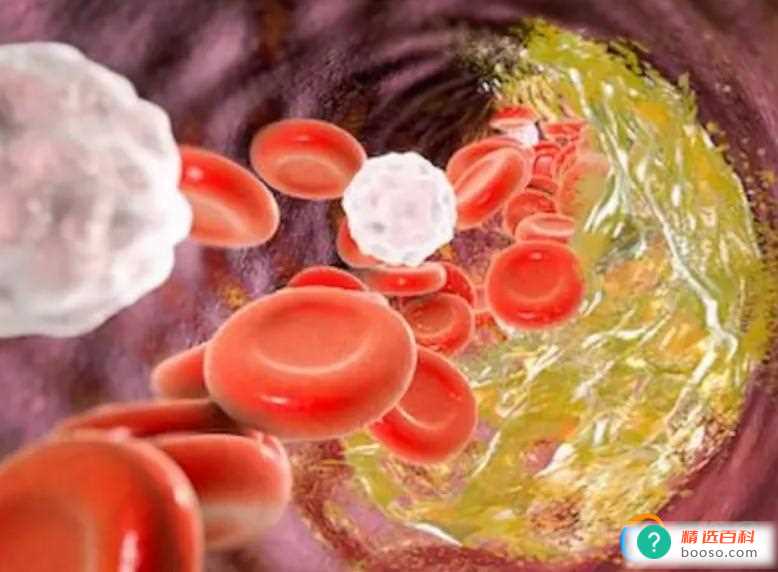 胆固醇高吃鸡蛋有影响吗(胆固醇患者的饮食结构怎么调理)