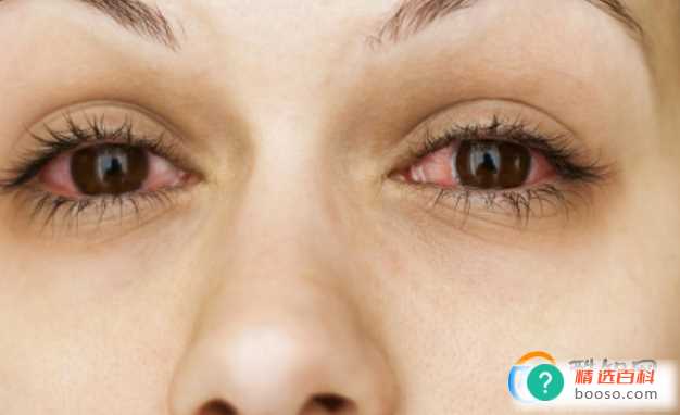 眼角痒是什么病的前兆